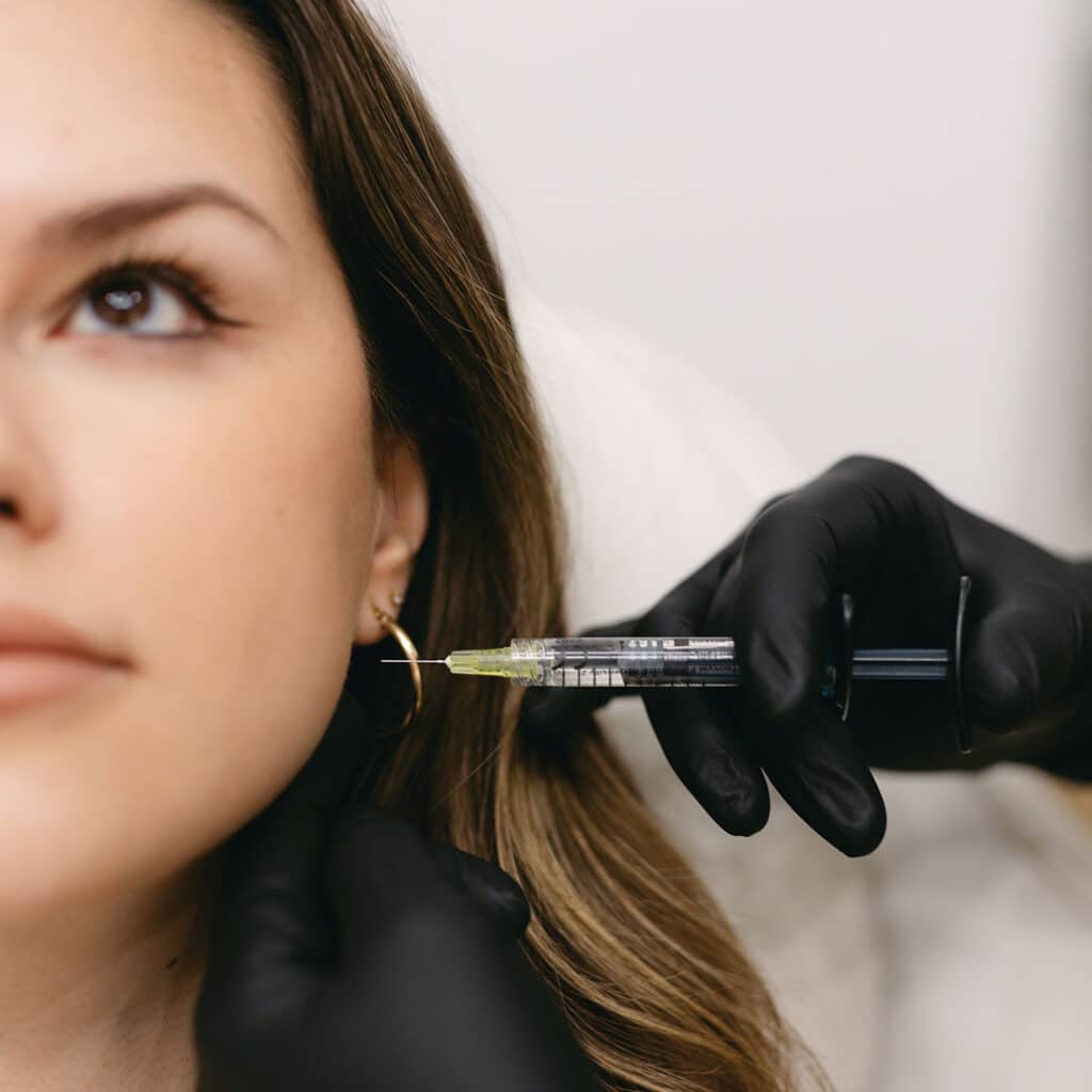 Dermal Filler at Subtly You