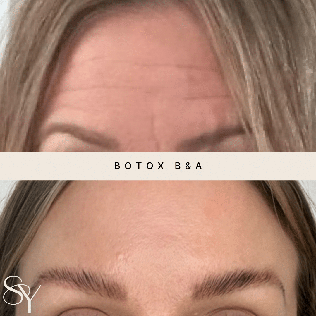 Original Subtly You before and after photographs