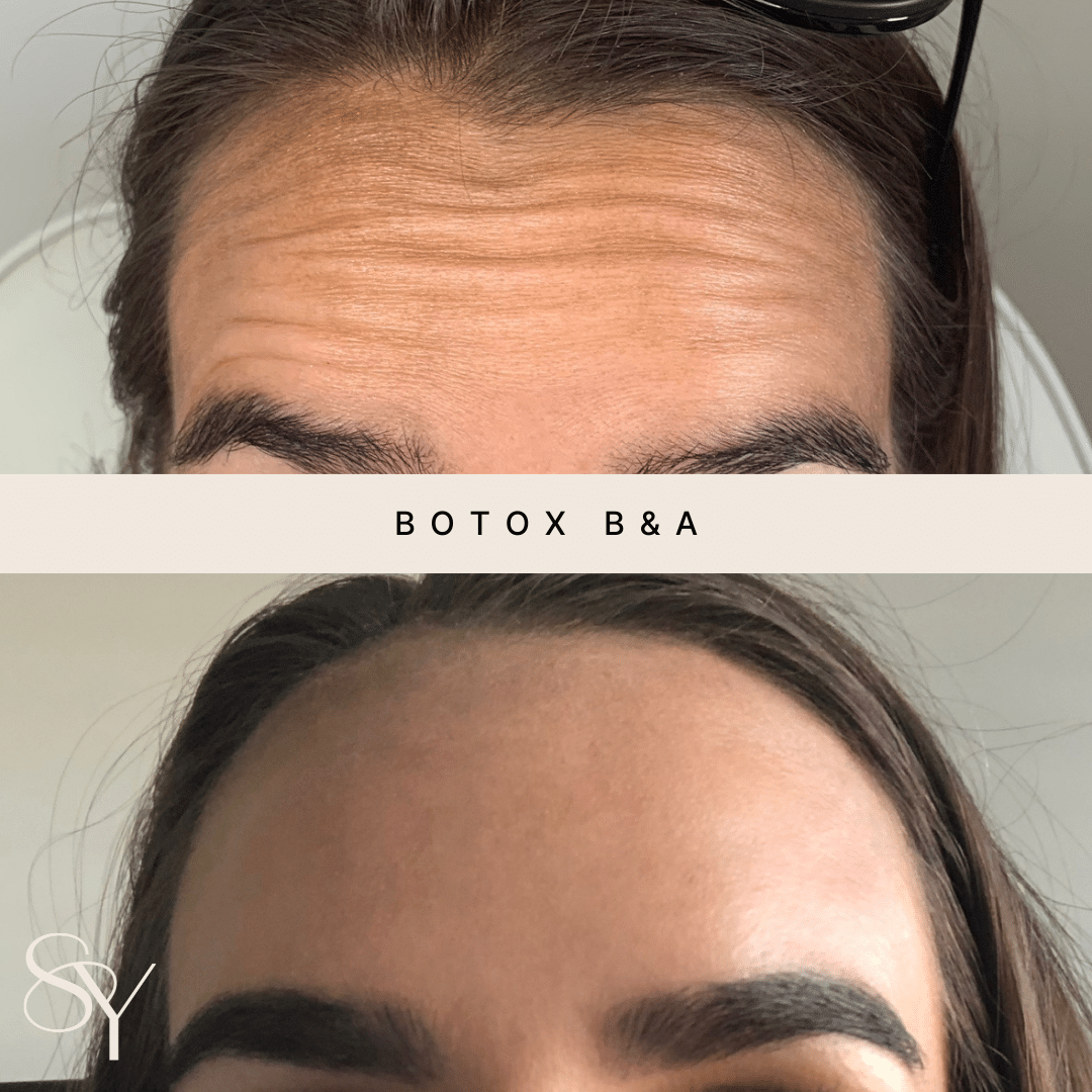 Original before and after photographs from Subtly You