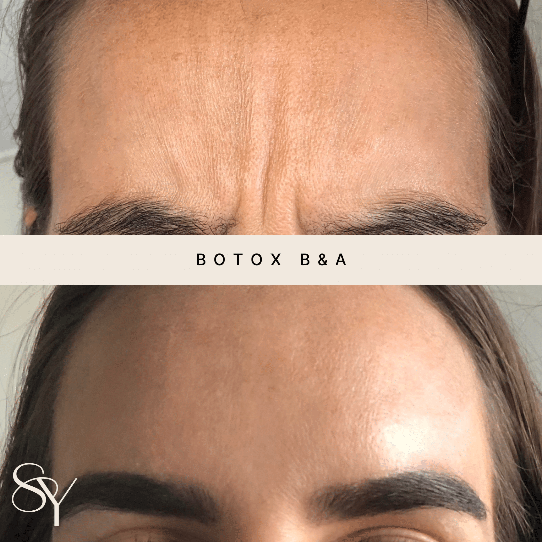 Original before and after photographs from Subtly You