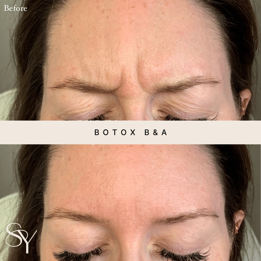 Original Subtly You before and after photographs