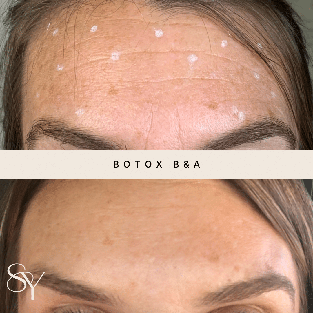Original Subtly You before and after photographs