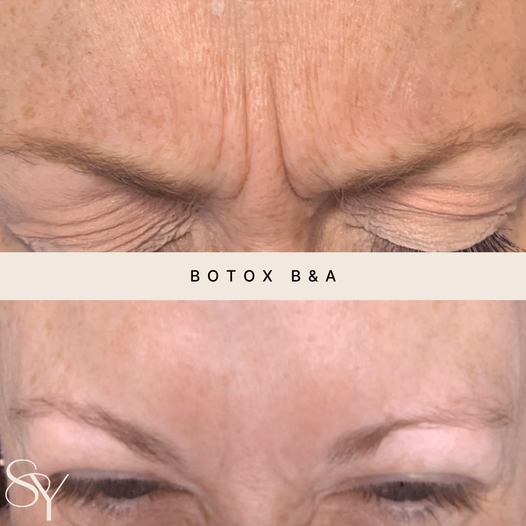 Original Subtly You before and after photographs