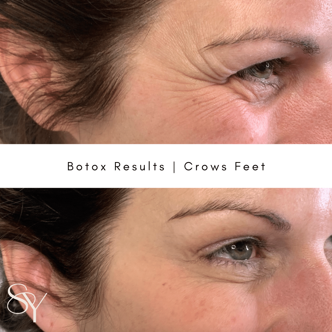 Original before and after photographs from Subtly You